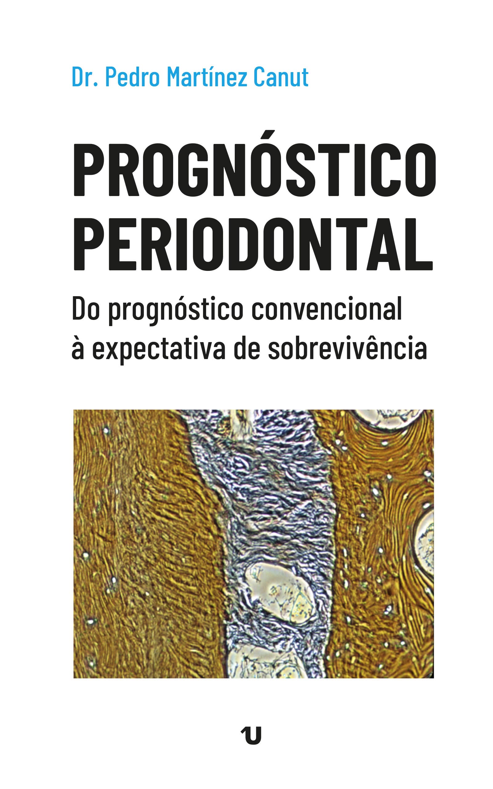 Periodontal Prognosis (ED. UNO)