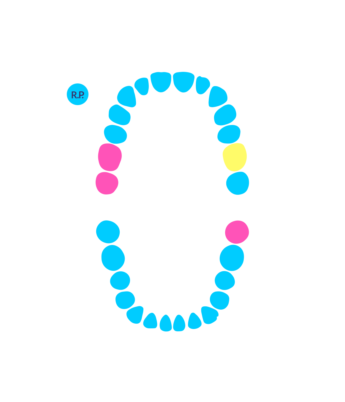 After using PerioProject